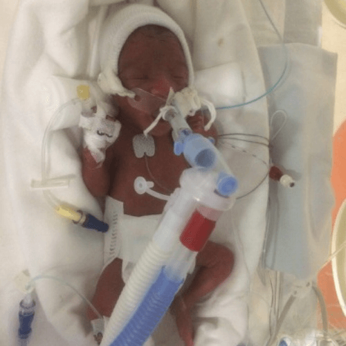 5 things Ickle Pickles’ mums wish they’d known before having a premature baby