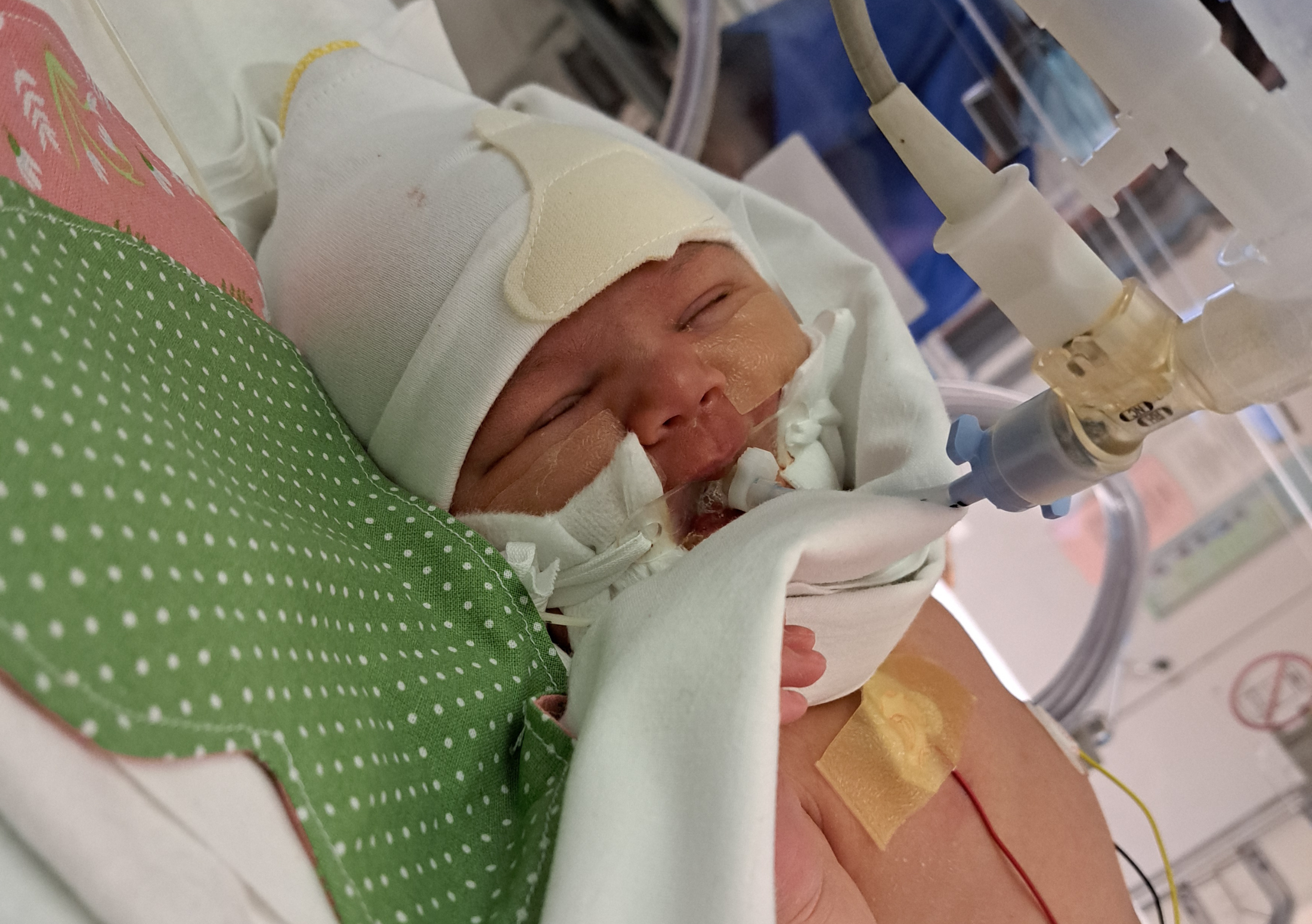 Baby Opal in NICU