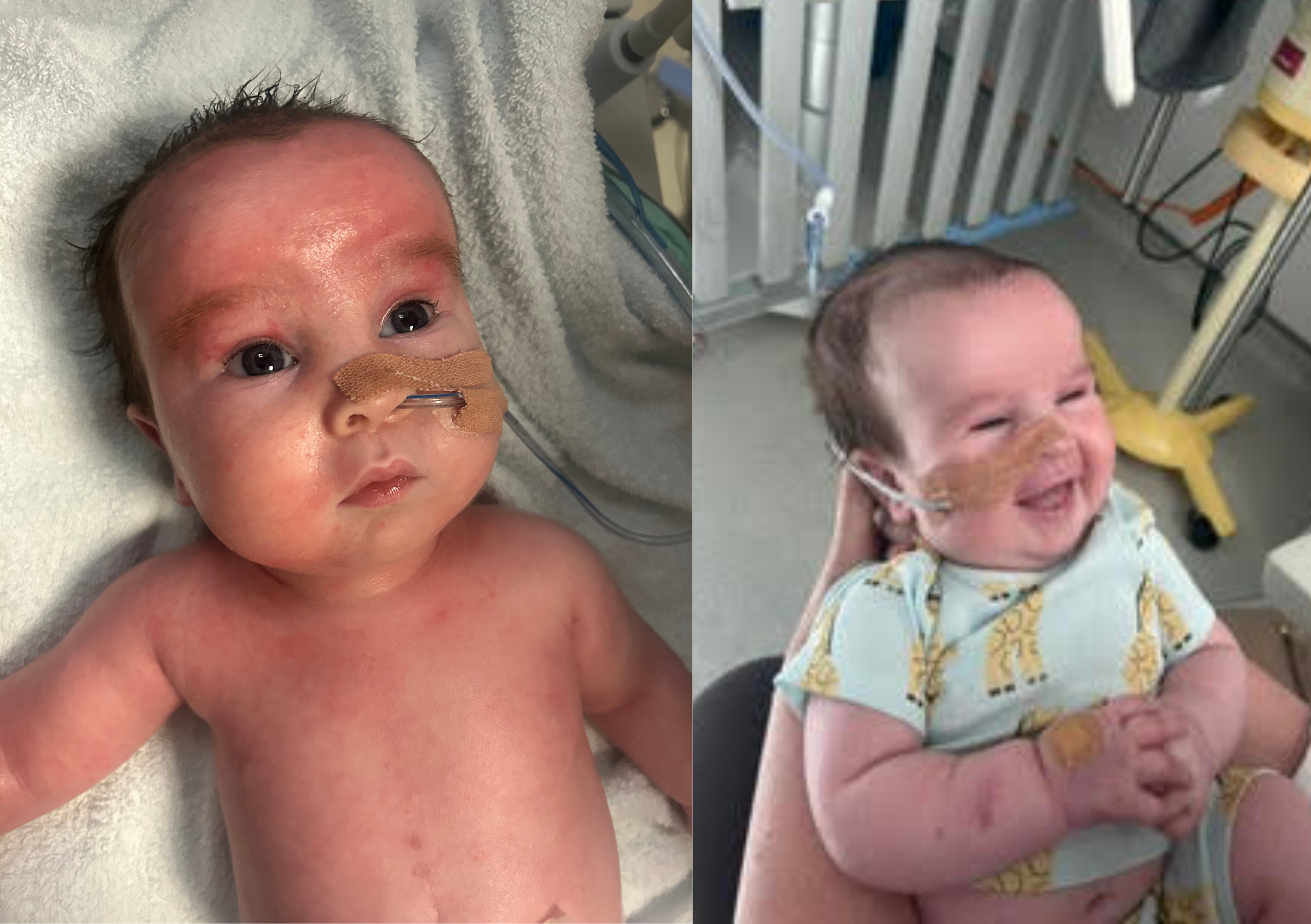 Two images of Freddie on the neonatal unit.
