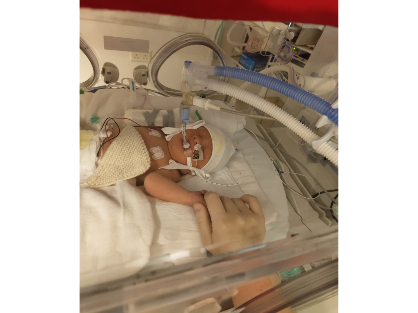 Baby Bodhi in an incubator